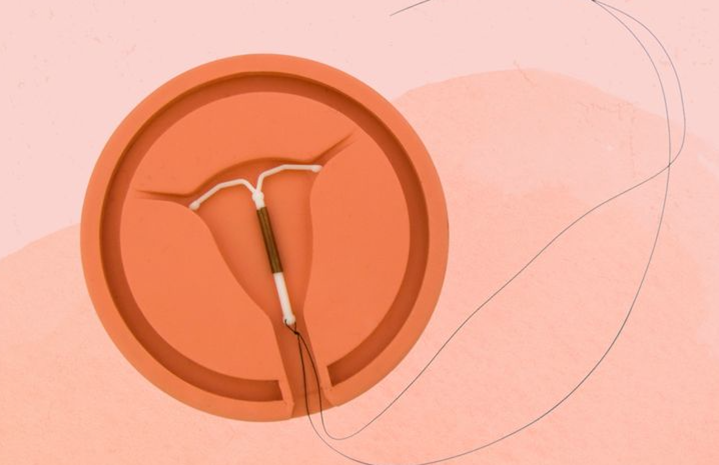 Is an IUD right for you? Types, benefits, risks & what to expect!