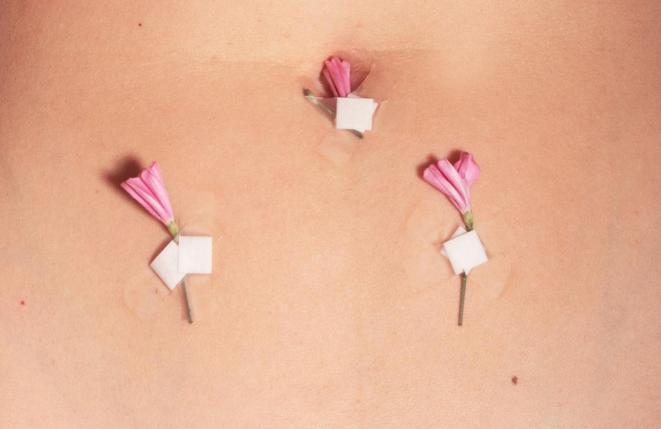 The truth about endometriosis: What every body deserves to know?